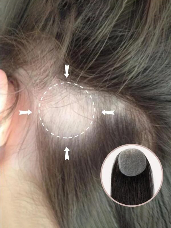 2"* 2" Full Skin Base Human Hair Cover Up Hair Patches  No Surgical Solution For Alopecia Areata